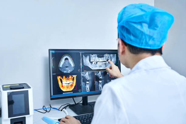 Best Emergency Root Canal Treatment in Troutman, NC